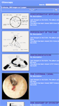 Mobile Screenshot of otoscopy.hawkelibrary.com
