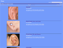 Tablet Screenshot of pinna.hawkelibrary.com